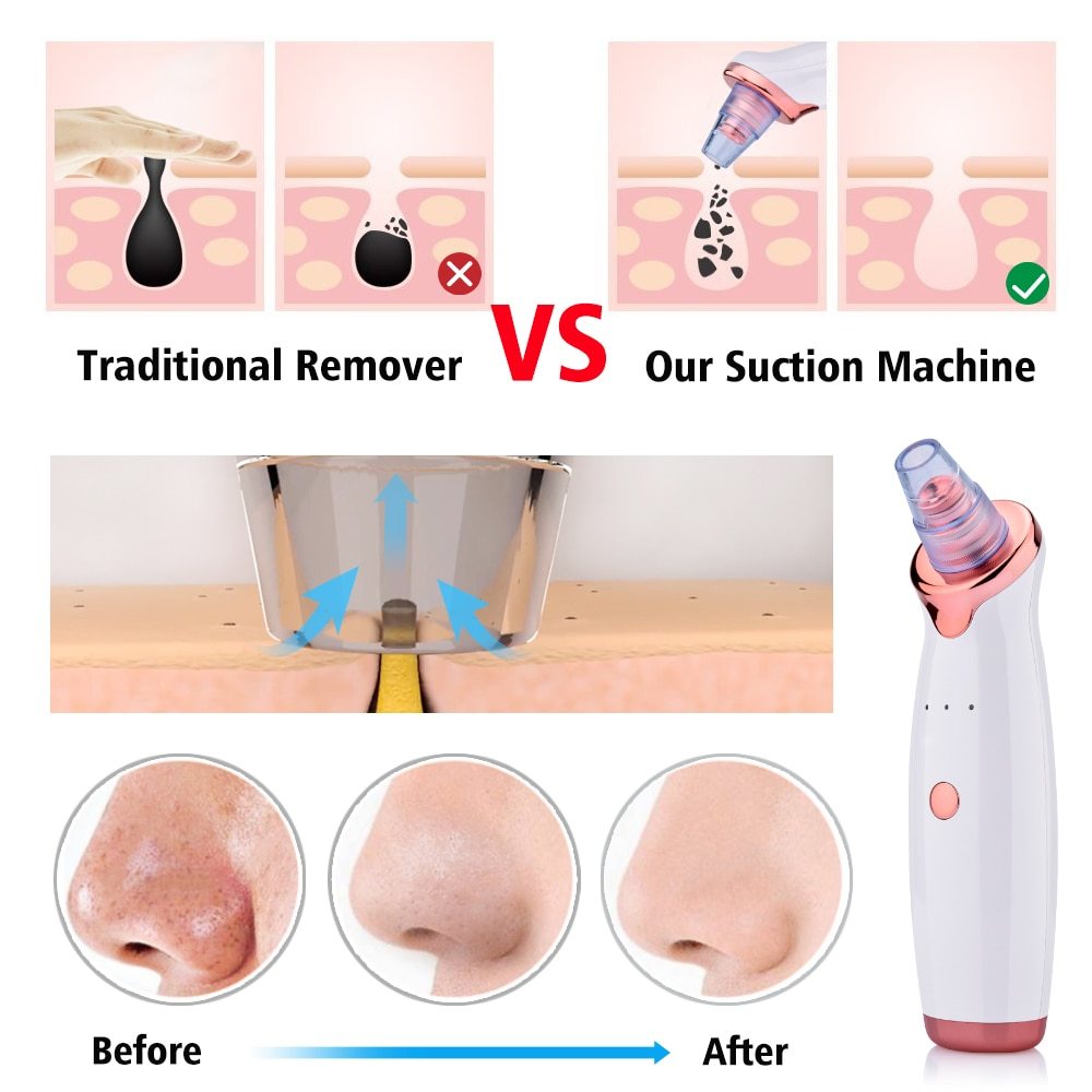 Blackhead Electric Suction Facial Washing Instrument