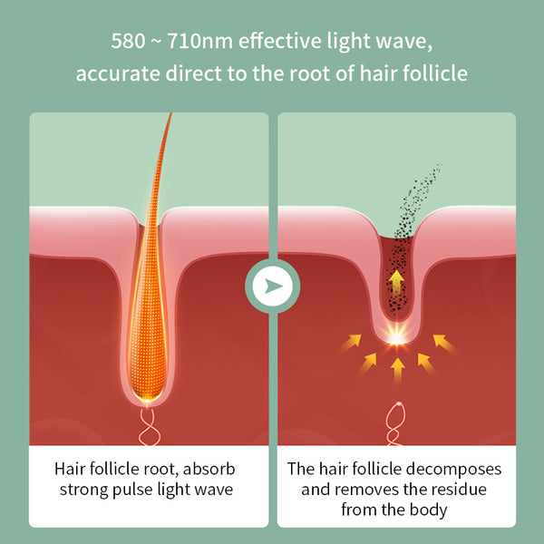 Women Painless Laser Epilator