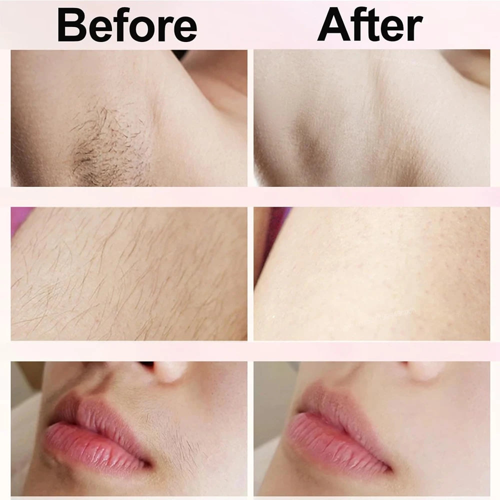 Electric Bikini Trimmer Epilator
