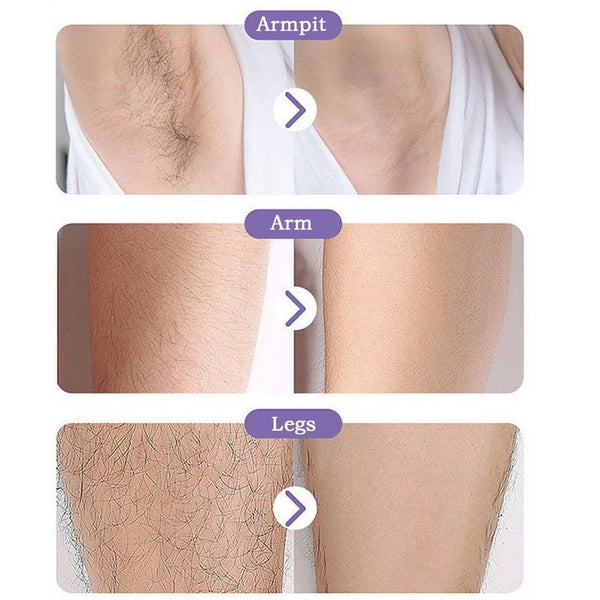 Painless Crystal Hair Removal
